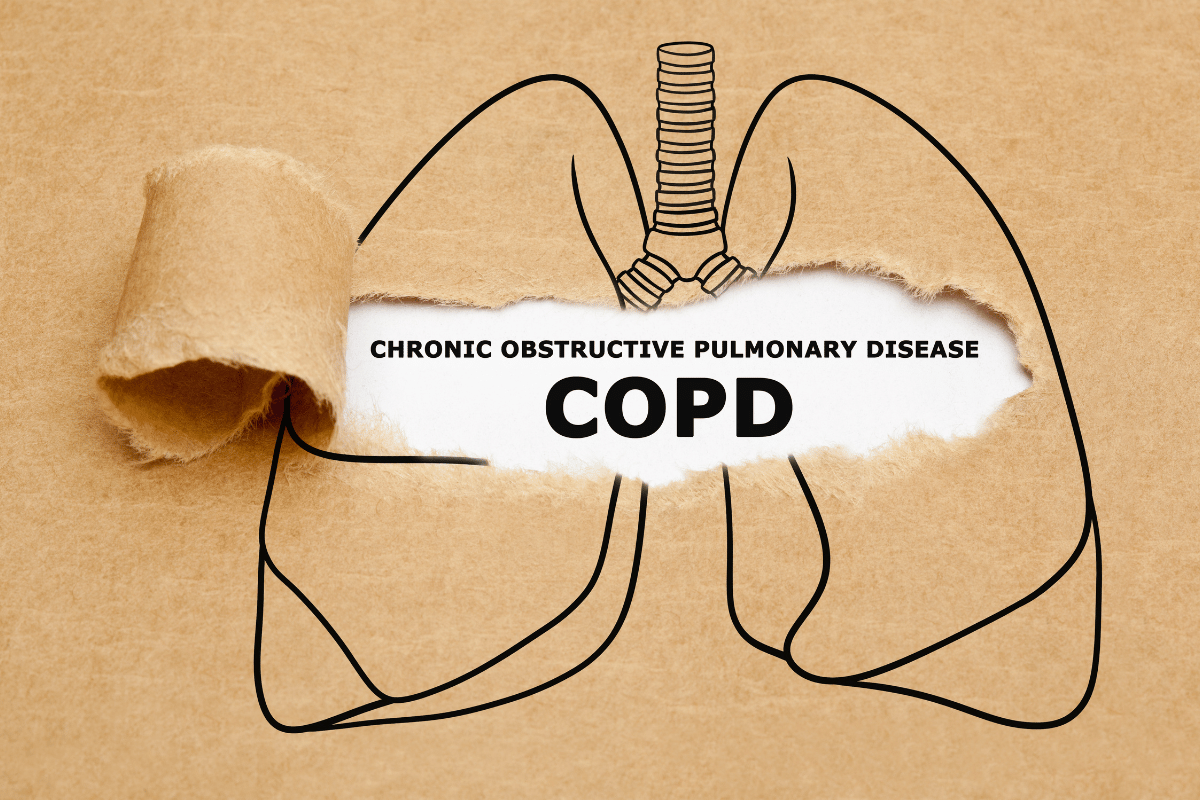 Chronic Obstructive Pulmonary Disease (COPD)​ | Best COPD Doctor in Mumbai